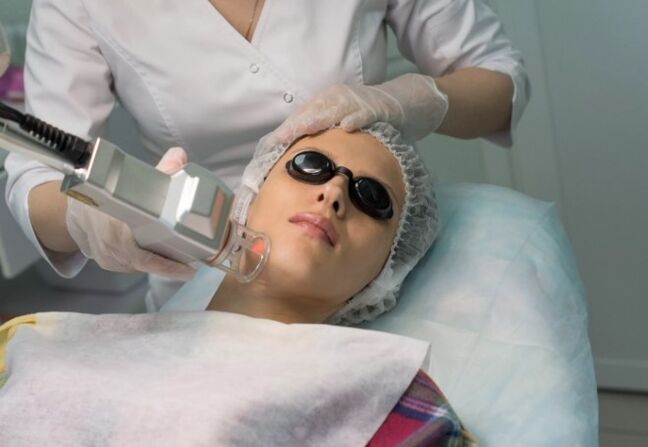 Verjüngung des Feldes durch einen Laser